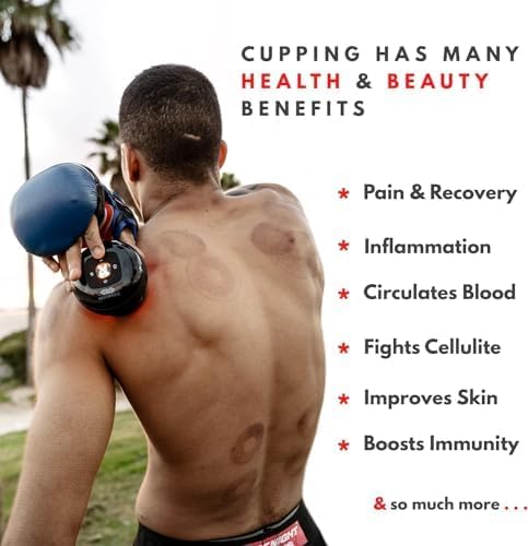 Electric Cupping Massager – Body Slimming & Anti-Cellulite Therapy