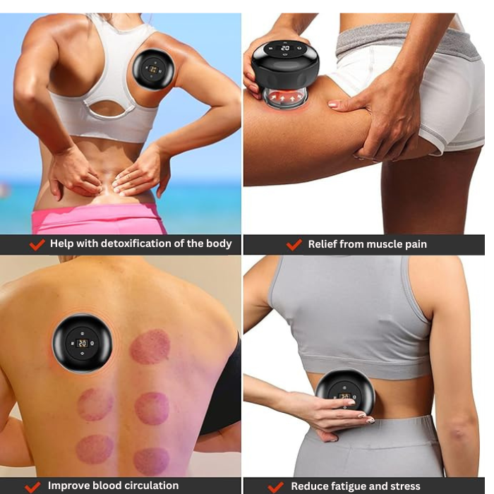 Electric Cupping Massager – Body Slimming & Anti-Cellulite Therapy
