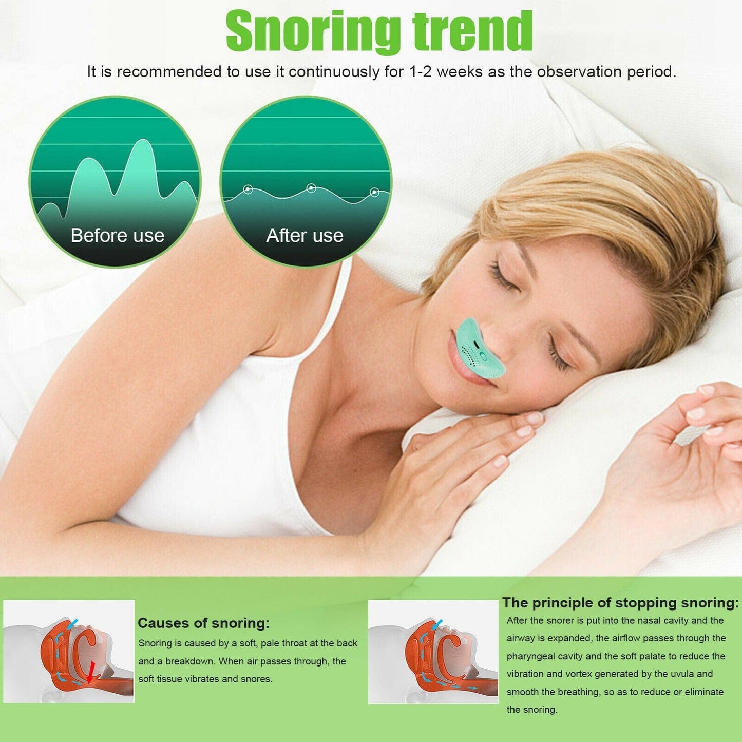 APROLO™ Electric Mini Anti Snoring Device
