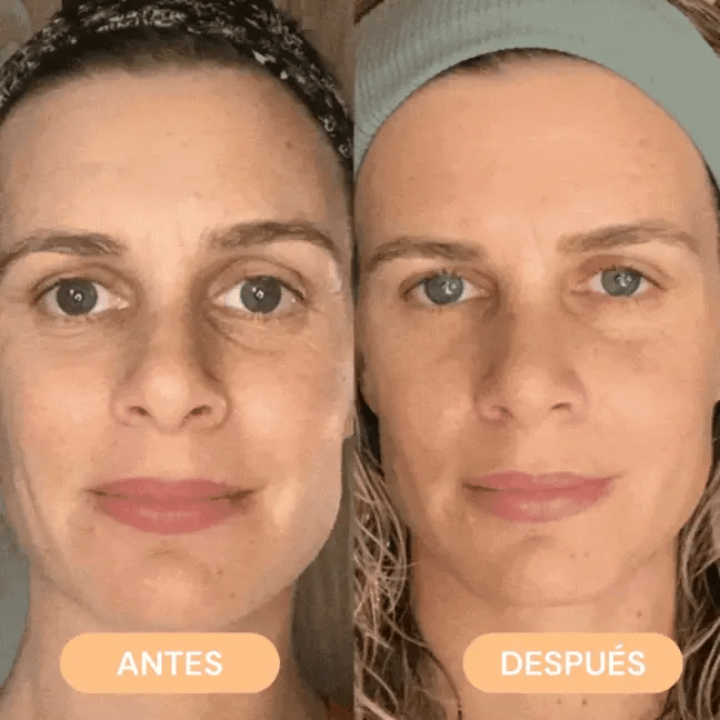 Masajeador de cuello ANTIPAPADA + Masajeador Facial frio/calor Antiarrugas + Mascarilla de té verde - Afrodita