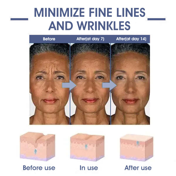 LOVILDS™ Advanced Firming & Wrinkle-Reducing Cream: Restore Skin Elasticity⭐