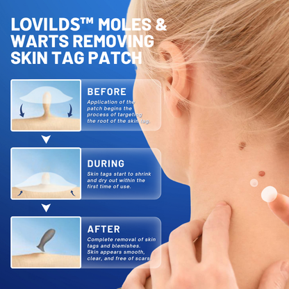 LOVILDS™ Moles & Warts Removing Skin Tag Patch