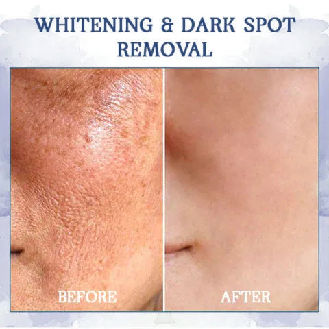 LOVILDS™ Advanced Firming & Wrinkle-Reducing Cream: Restore Skin Elasticity⭐