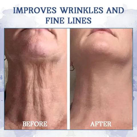 LOVILDS™ Advanced Firming & Wrinkle-Reducing Cream: Restore Skin Elasticity⭐