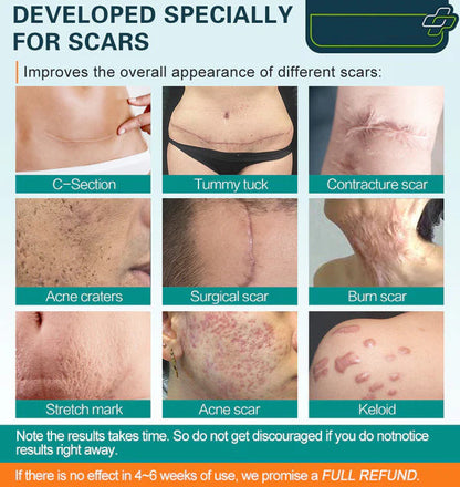 Advanced Scar Spray For All Types of Scars