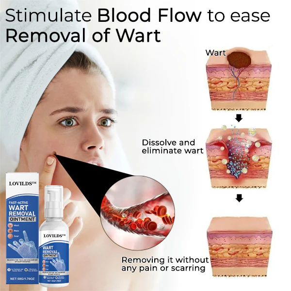 Aprolo™ Fast-Active Wart Removal Ointment