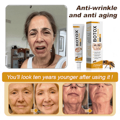 TLOPA® Botox Bee Venom Wrinkle Removal Cream