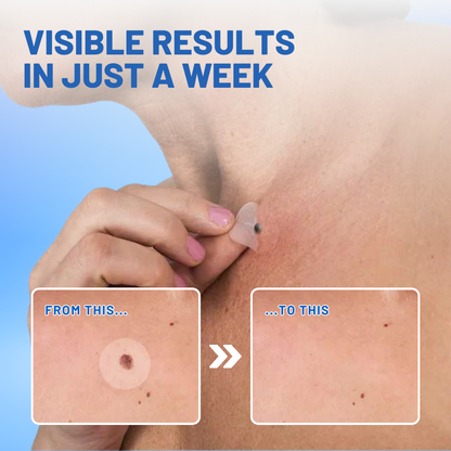 LOVILDS™ Moles & Warts Removing Skin Tag Patch