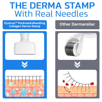 Flysmus™ PockmarksNeedling Collagen Derma Stamp