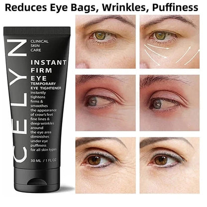 Celyn™ Instant Eye Bag Firming Cream