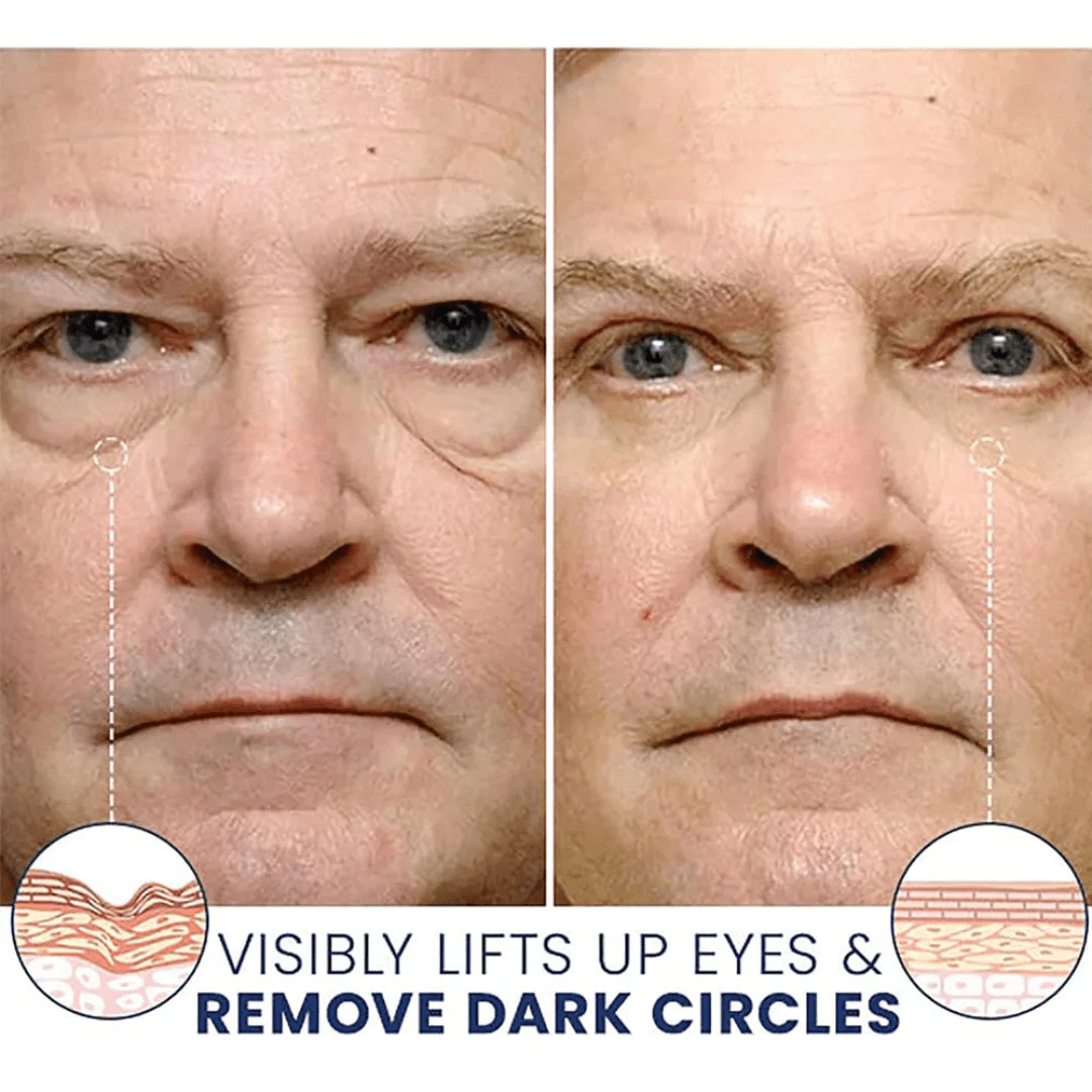 Celyn™ Instant Eye Bag Firming Cream