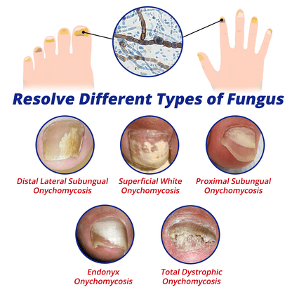 GFOUK™ NailFortify Rapid Growth Treatment Serum