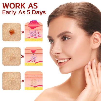 Aprolo™ WipeOff Tags And Moles Remover