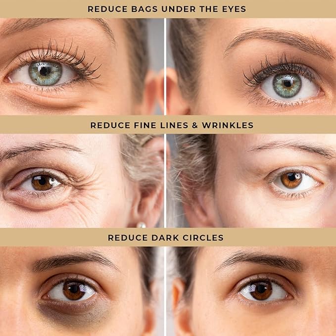 Celyn™ Instant Eye Bag Firming Cream