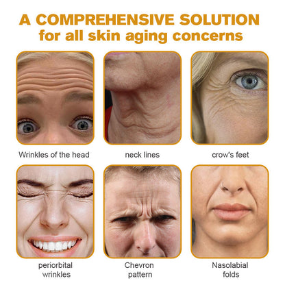 TLOPA® Botox Bee Venom Wrinkle Removal Cream