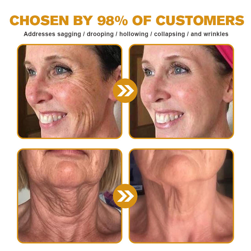 TLOPA® Botox Bee Venom Wrinkle Removal Cream