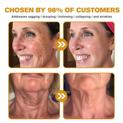 TLOPA® Botox Bee Venom Wrinkle Removal Cream