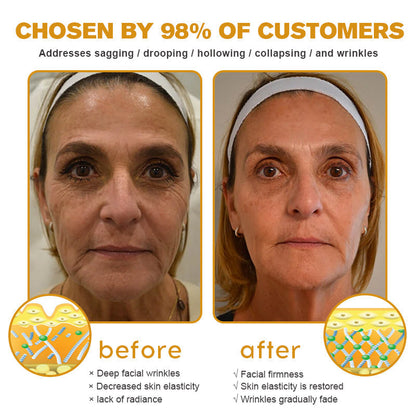 TLOPA® Botox Bee Venom Wrinkle Removal Cream