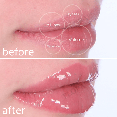 [Official Brand Store]💎💎2024 TLOPA™ Foaming Technology Herbal Lip Balm