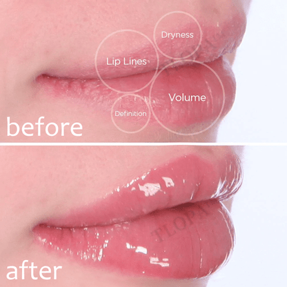 [Official Brand Store]💎💎2024 TLOPA™ Foaming Technology Herbal Lip Balm