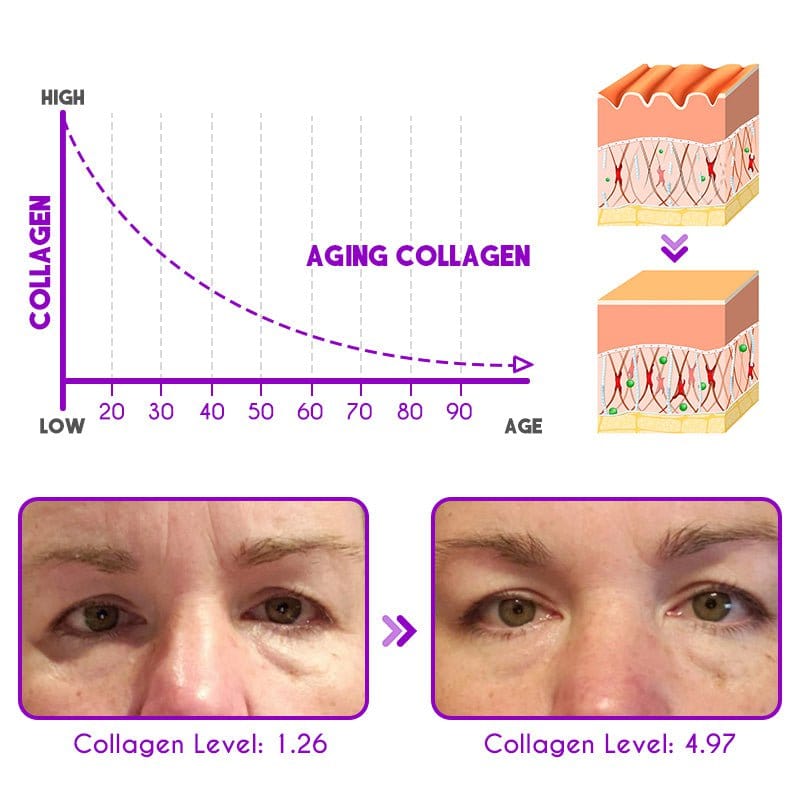 Flysmus™ DEleventh Pro-Xylane Active Eye Cream